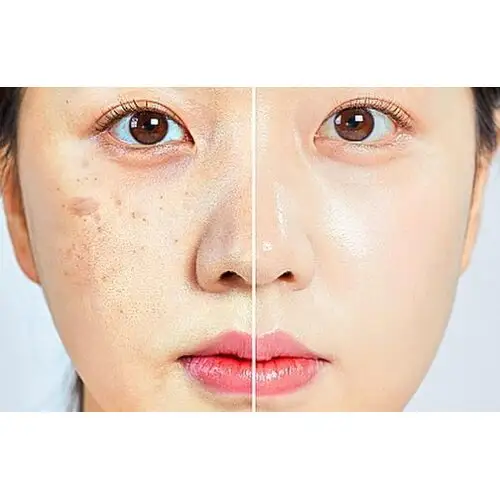 Derma Factory – Peptide Lifting & Wrinkle Smoothing Serum (Matrixyl), Пептидна сироватка для ліфтингу та розгладження зморшок Matrixyl, 30 мл.