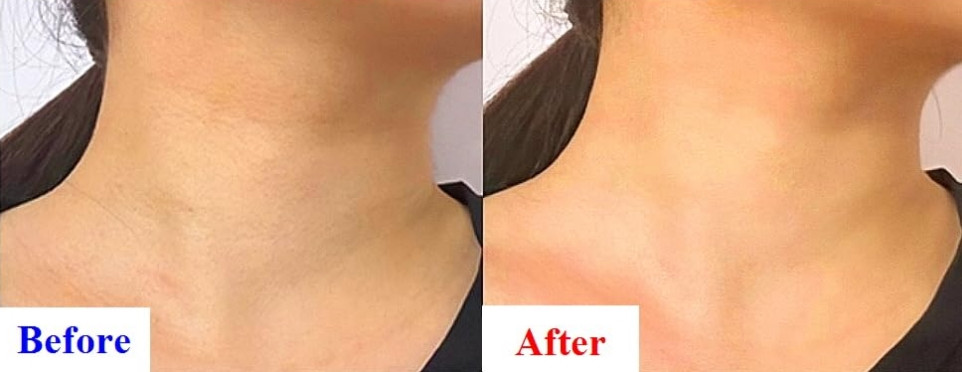 Derma Factory – Peptide Lifting & Wrinkle Smoothing Serum (Matrixyl), Пептидна сироватка для ліфтингу та розгладження зморшок Matrixyl, 30 мл.