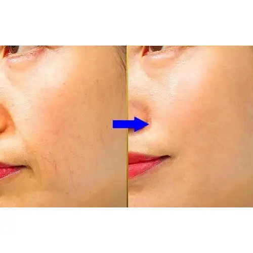 Derma Factory – Peptide Lifting & Wrinkle Smoothing Serum (Matrixyl), Пептидна сироватка для ліфтингу та розгладження зморшок Matrixyl, 30 мл.